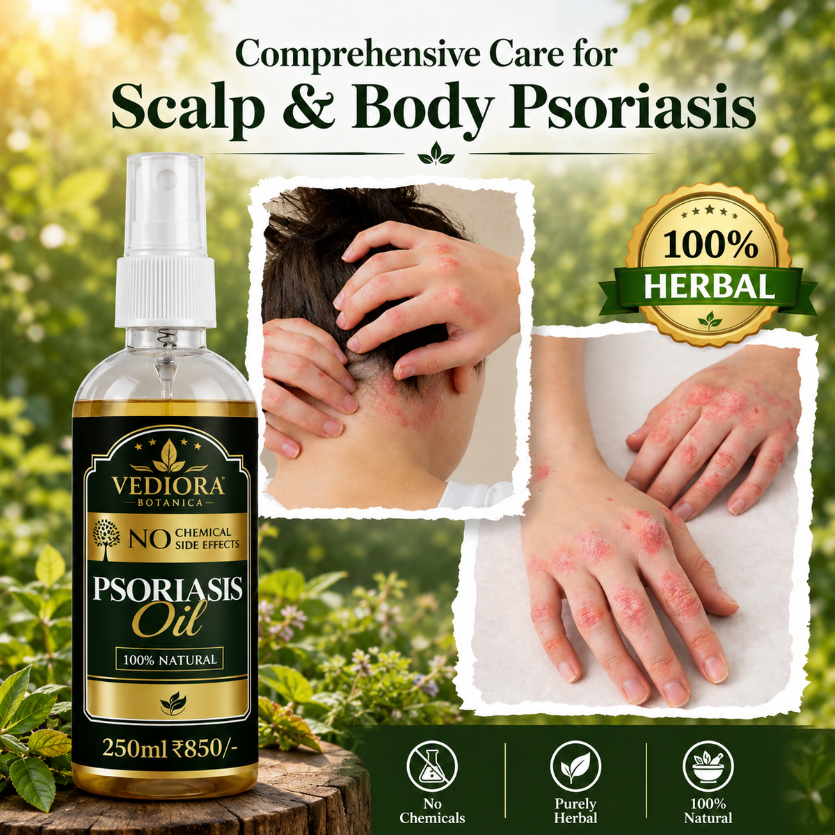 Garuda Herbal Psoriasis Oil-Advanced Psoriasis Clearing Oil